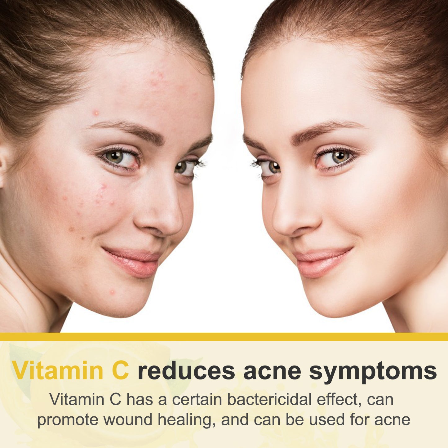 KNCIUYOR ADVANCED VITAMIN C CREAM Natural Antioxidant