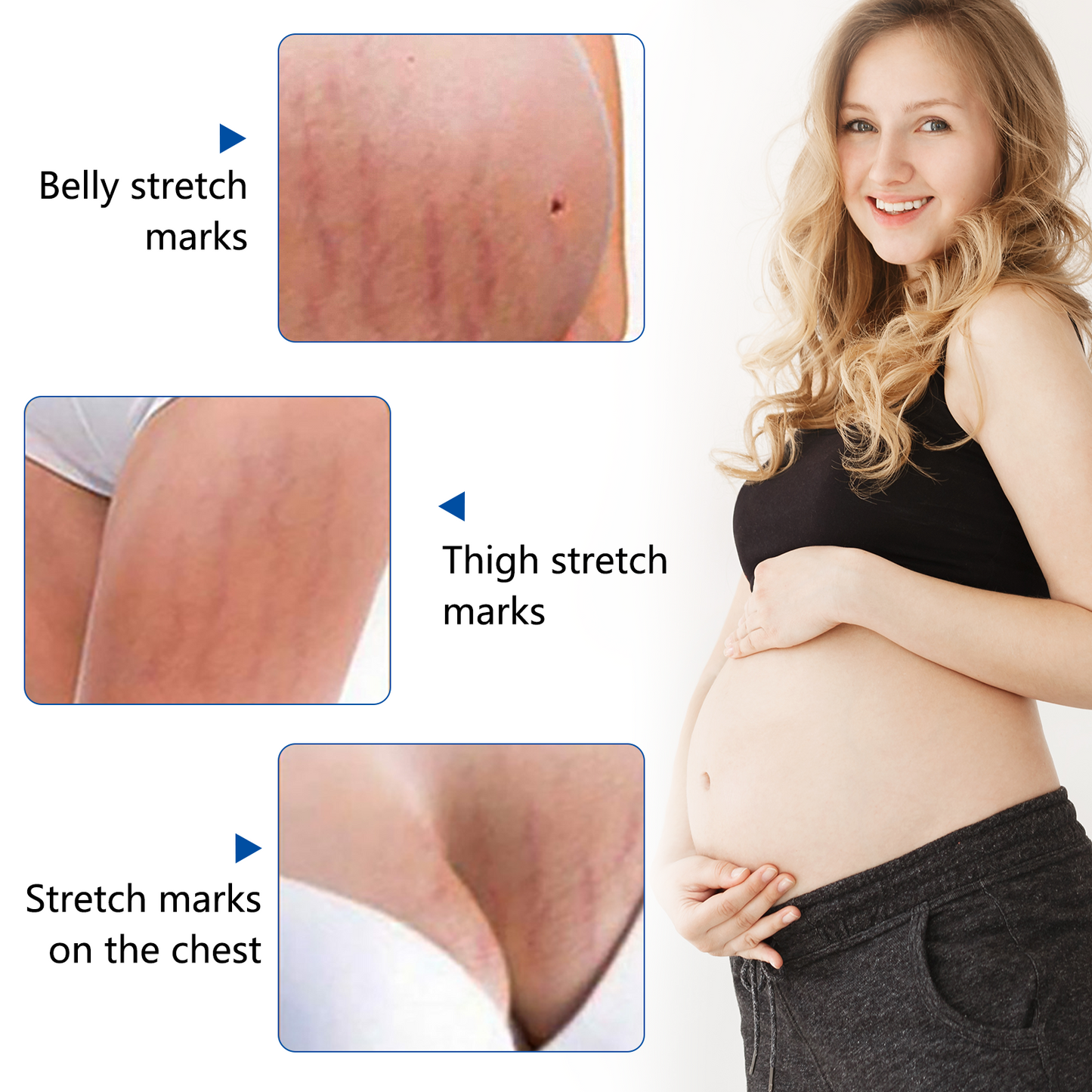 Sefudun Anti-Stretch Mark Essential Oil