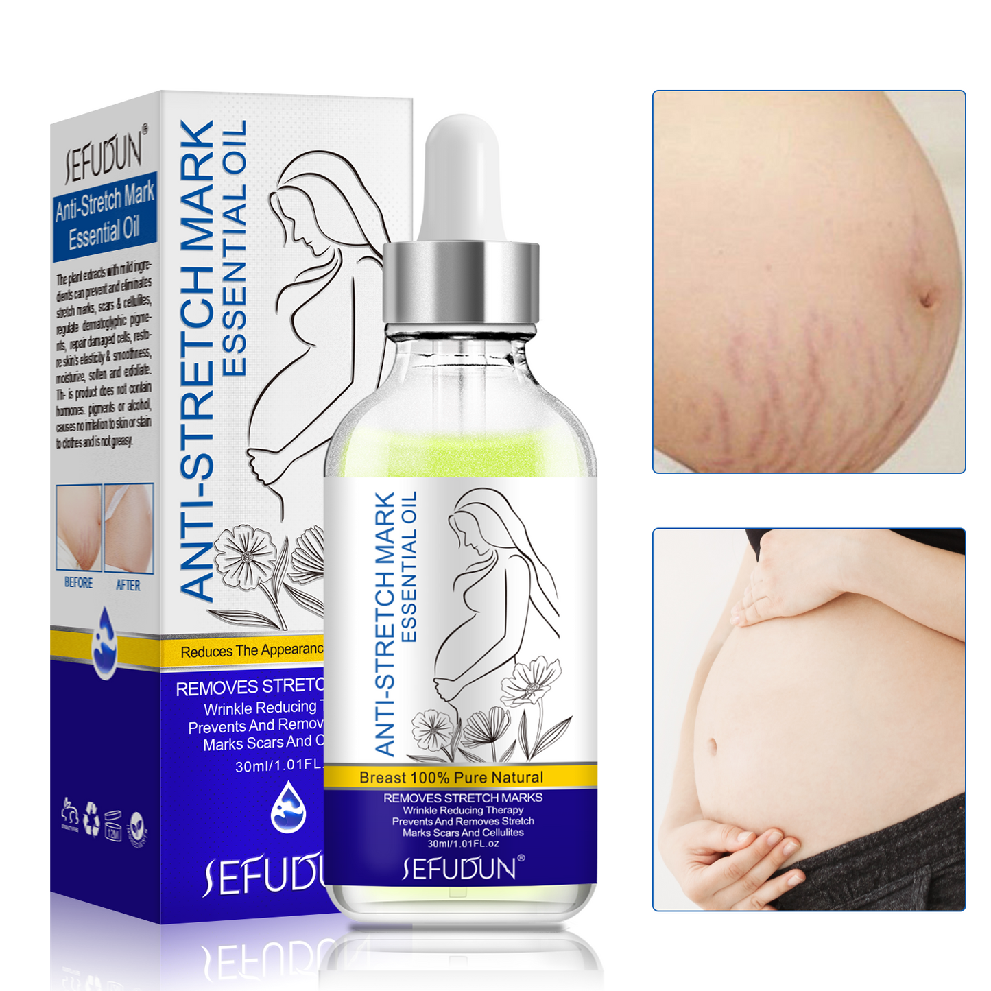 Sefudun Anti-Stretch Mark Essential Oil