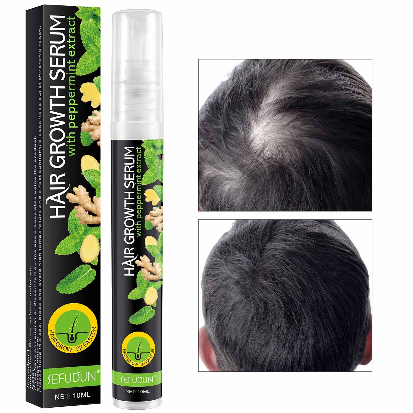 Sefudun Mint Hair Growth Serum