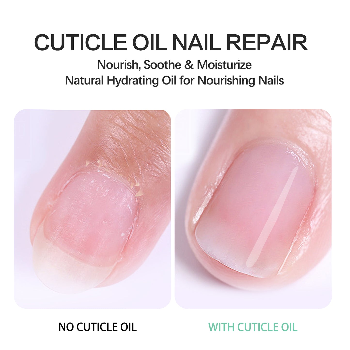 VIOFAIRY CUTICLE OIL NAIL REPAIR