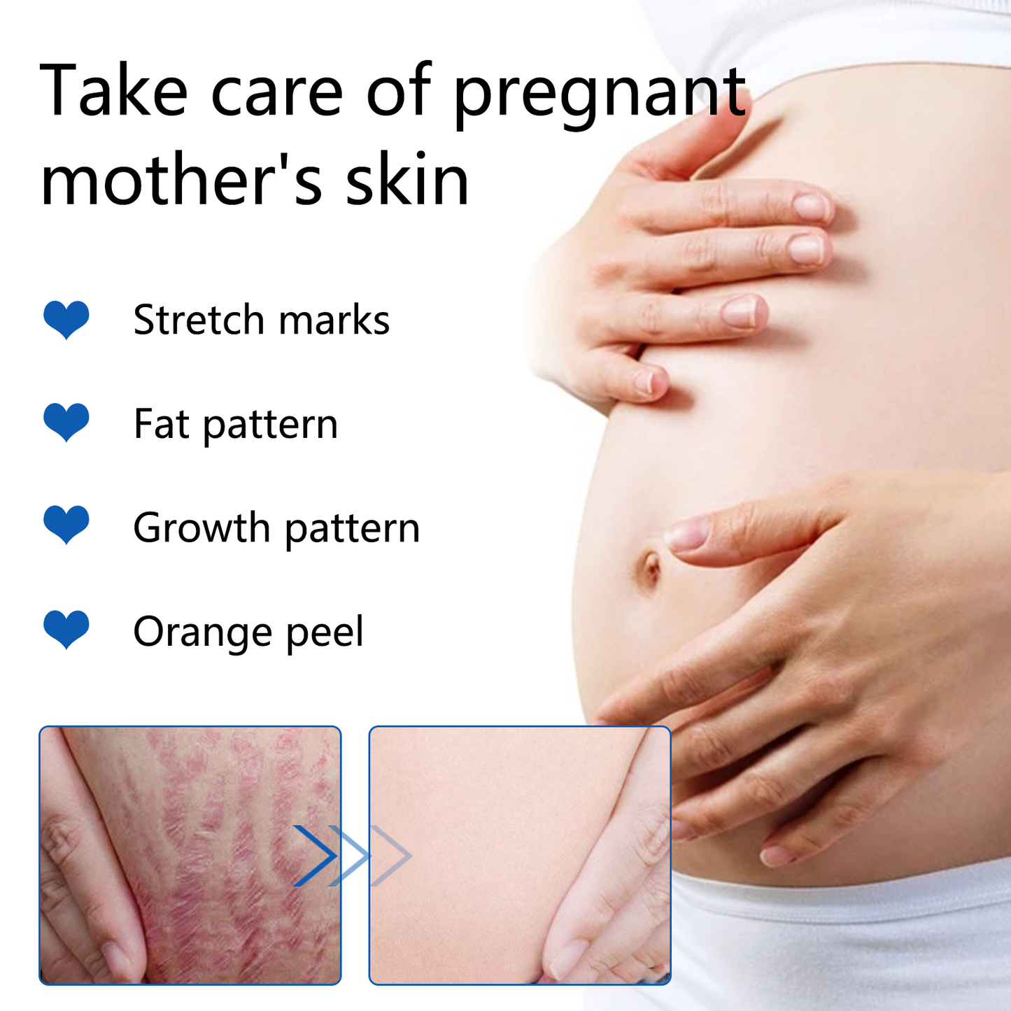 Sefudun Anti-Stretch Mark Essential Oil
