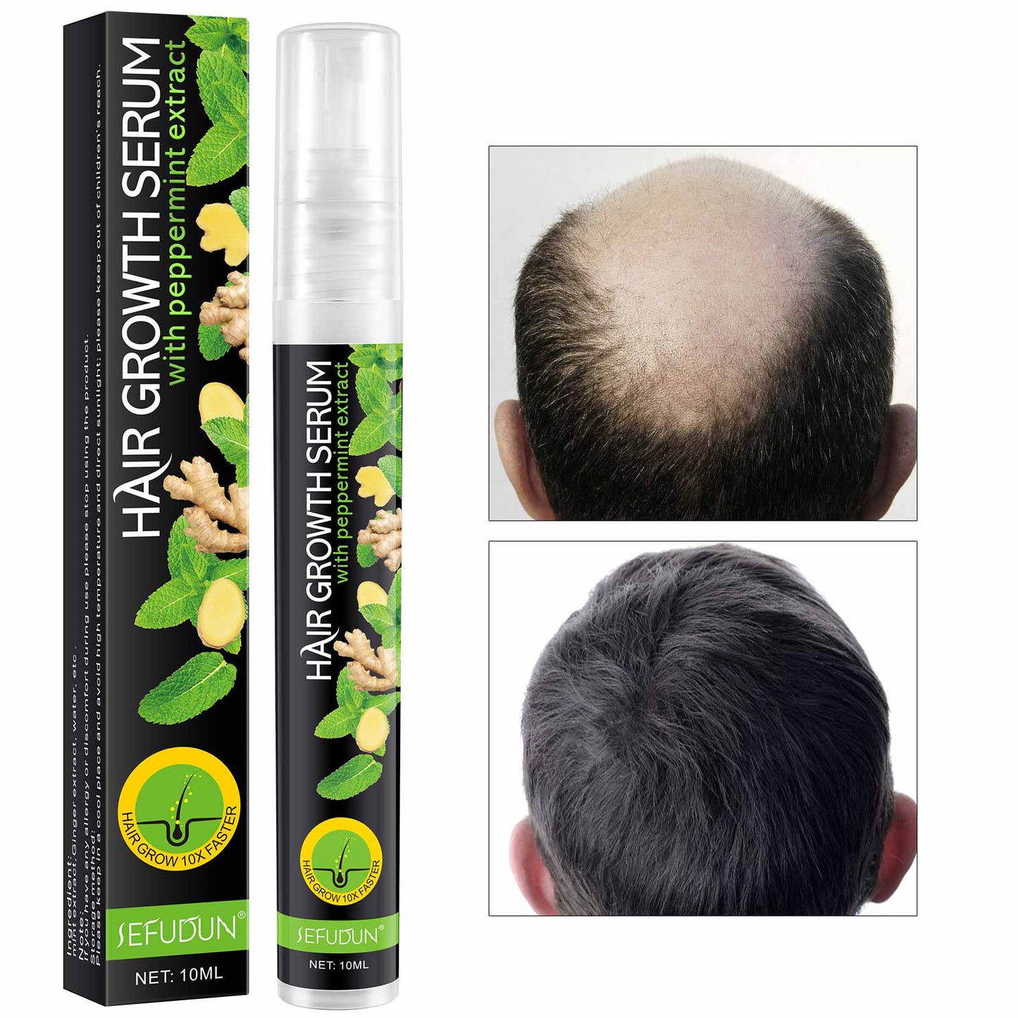 Sefudun Mint Hair Growth Serum