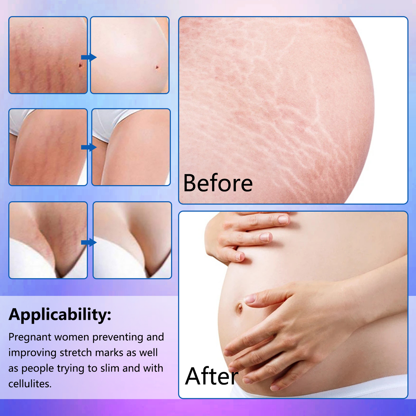 Sefudun Anti-Stretch Mark Essential Oil