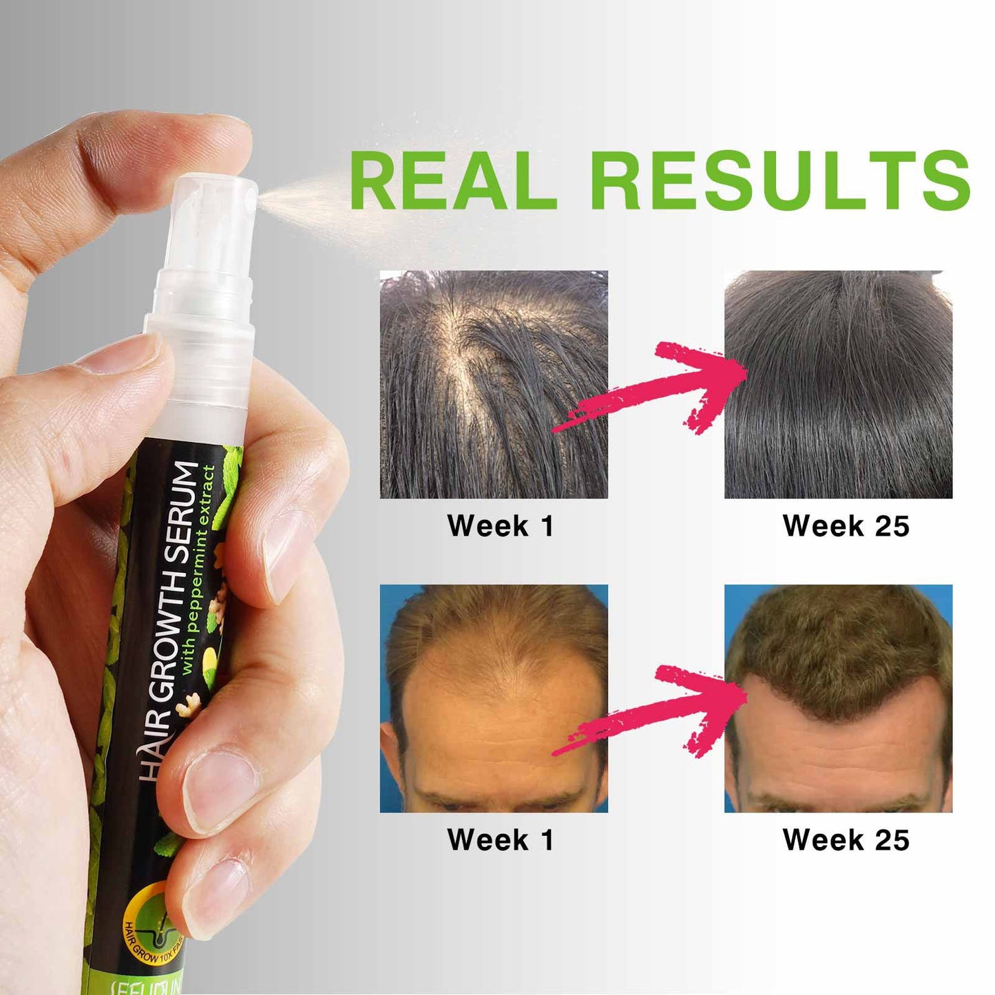 Sefudun Mint Hair Growth Serum