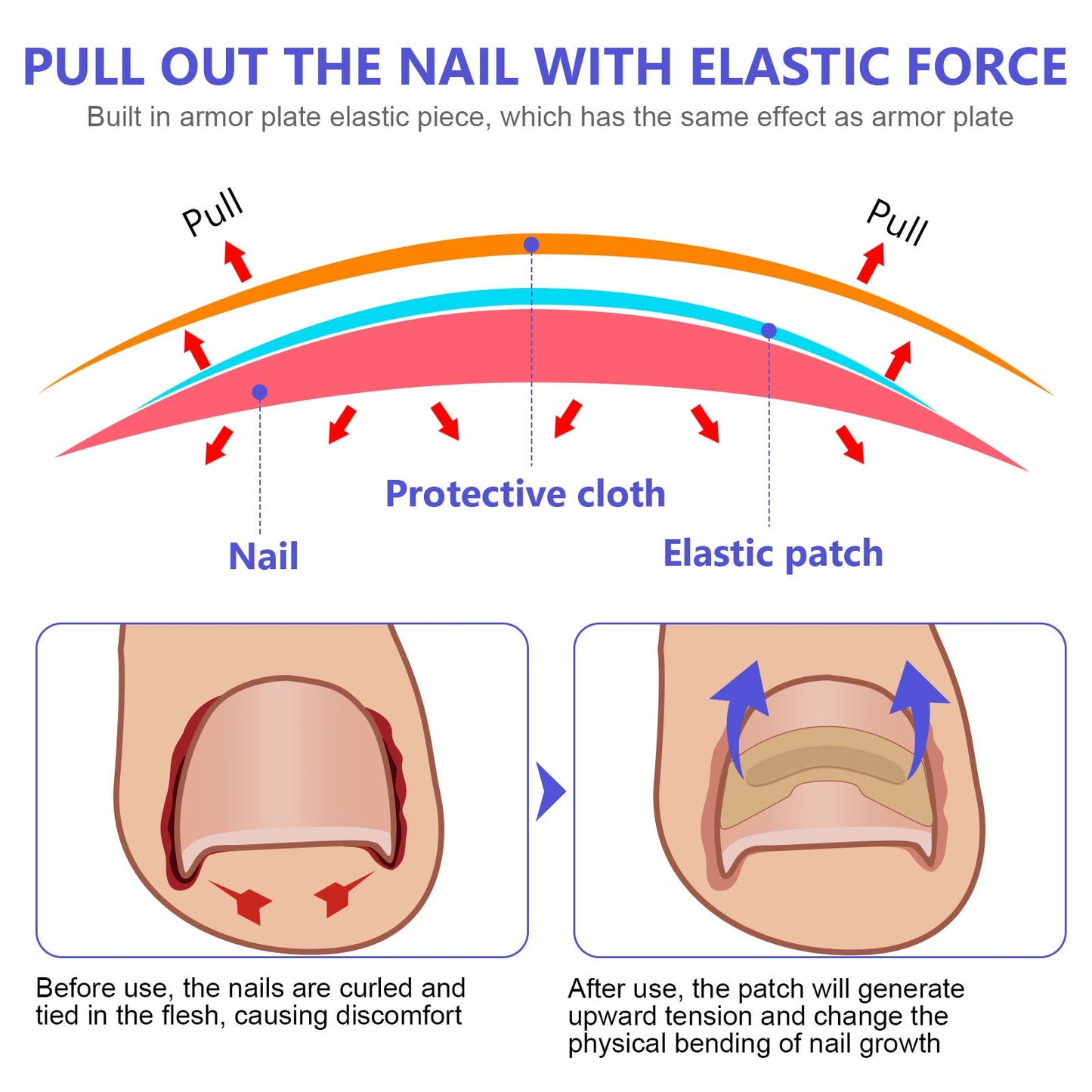 Sefudun Toenail Correction Stickers