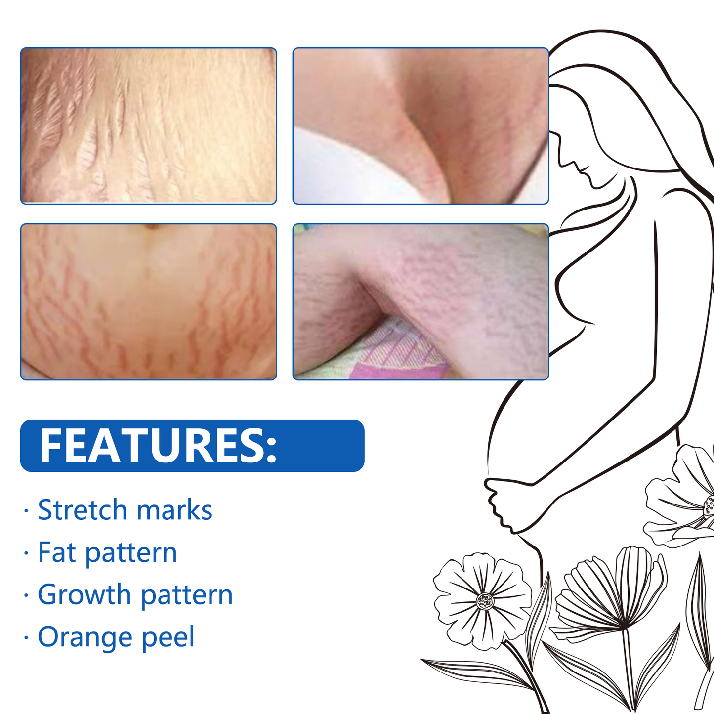Sefudun Anti-Stretch Mark Essential Oil