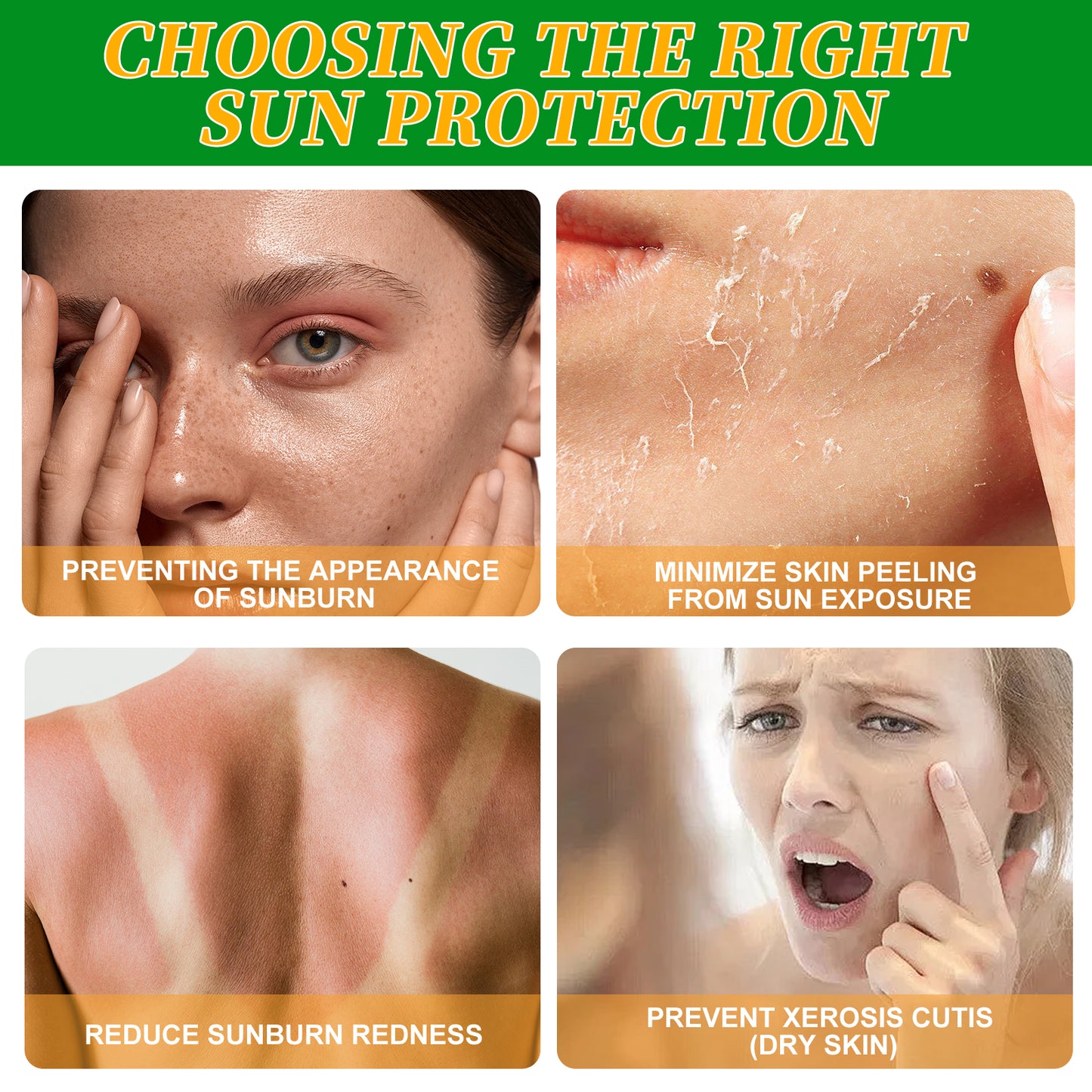 TUDIQE Cosmetic preparations against sunburn