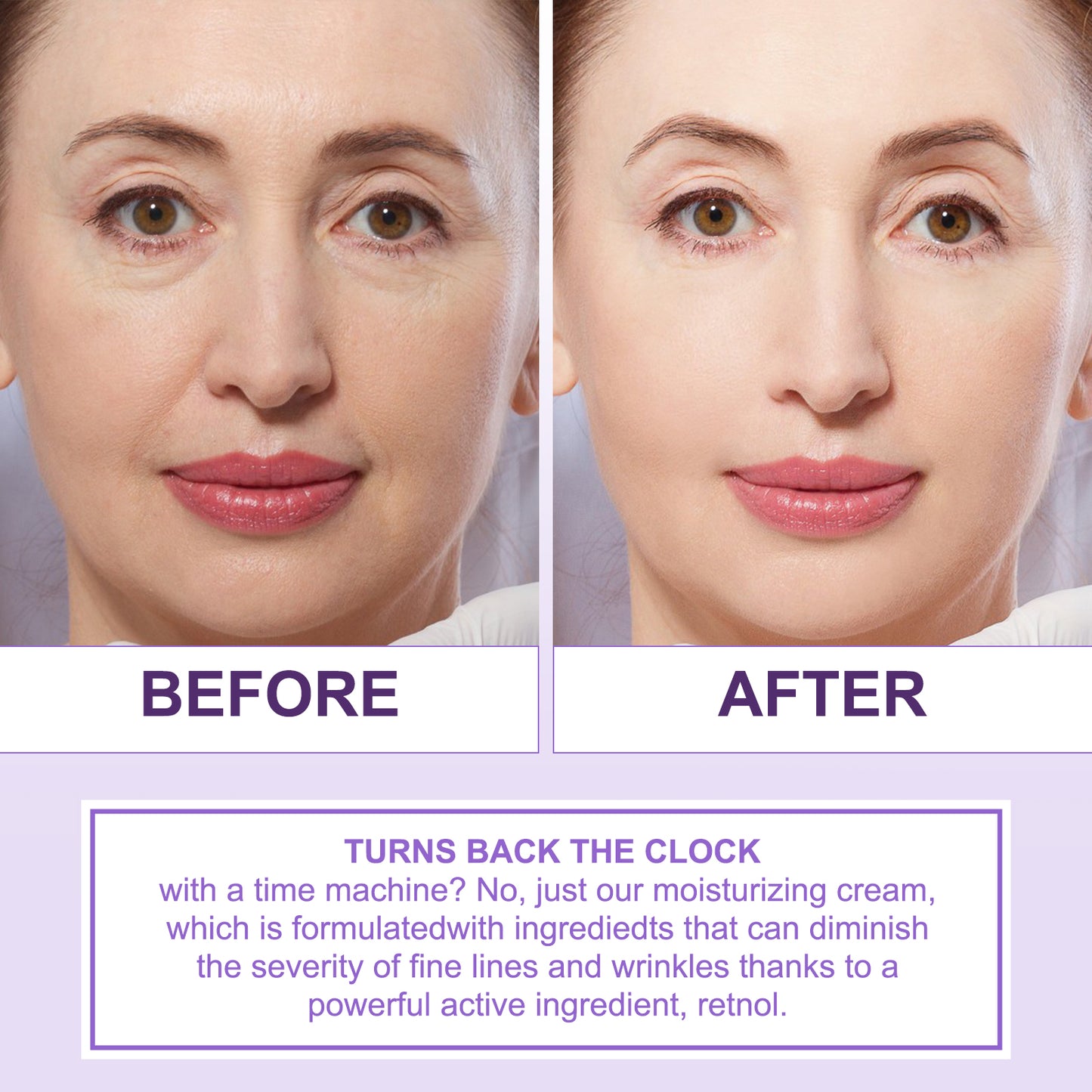 Lofuanna ADVANCED RETINOL CREAM