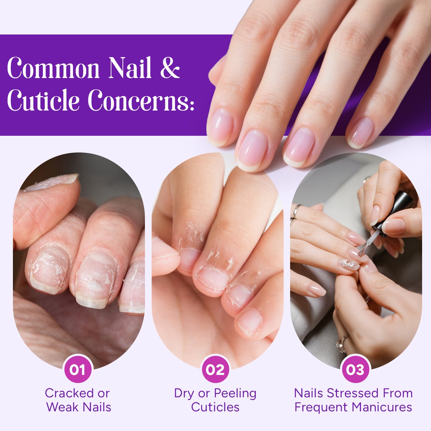 4-in-1 Cutide Pusher Pen