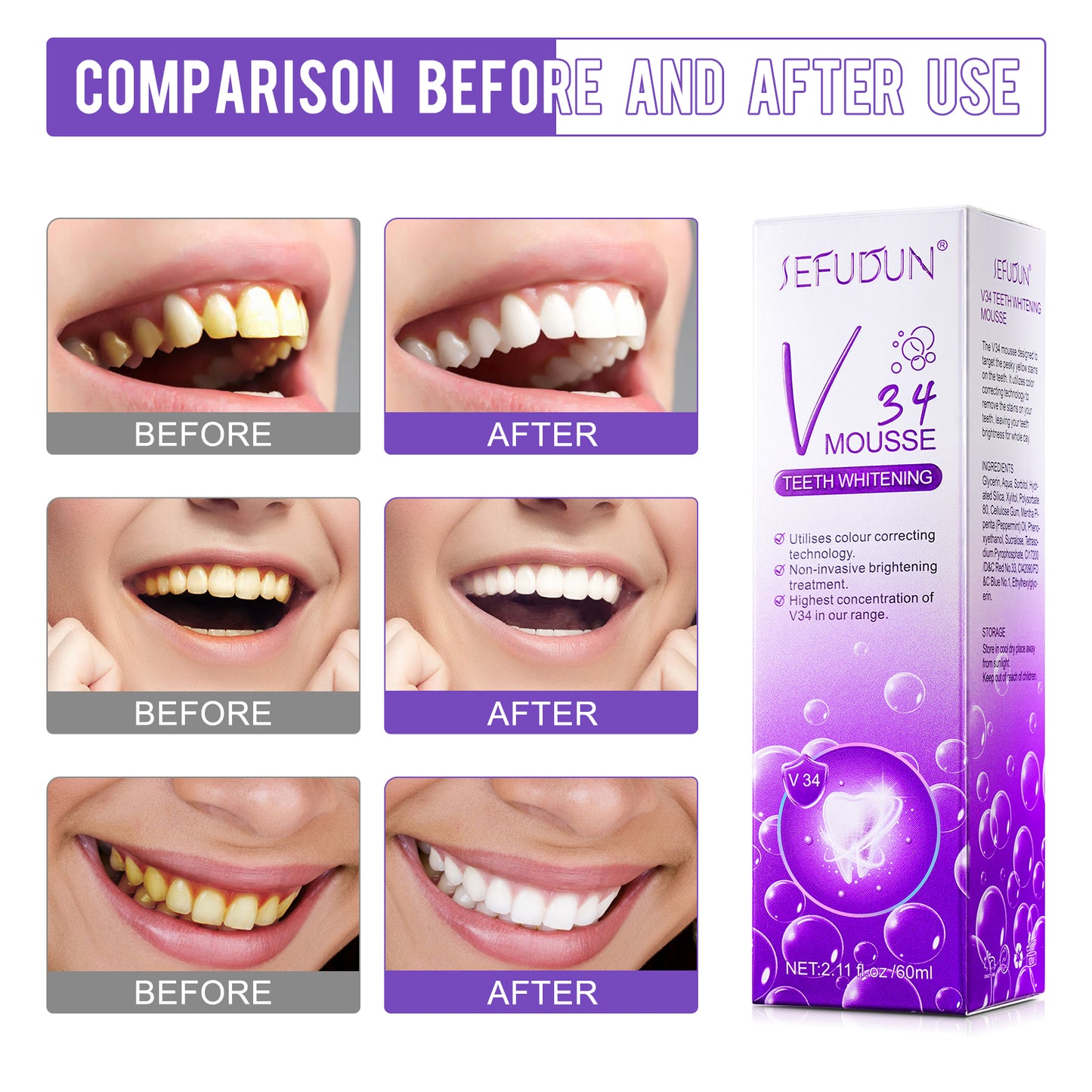 sefudun V34 MOUSSE TEETH WHITENING