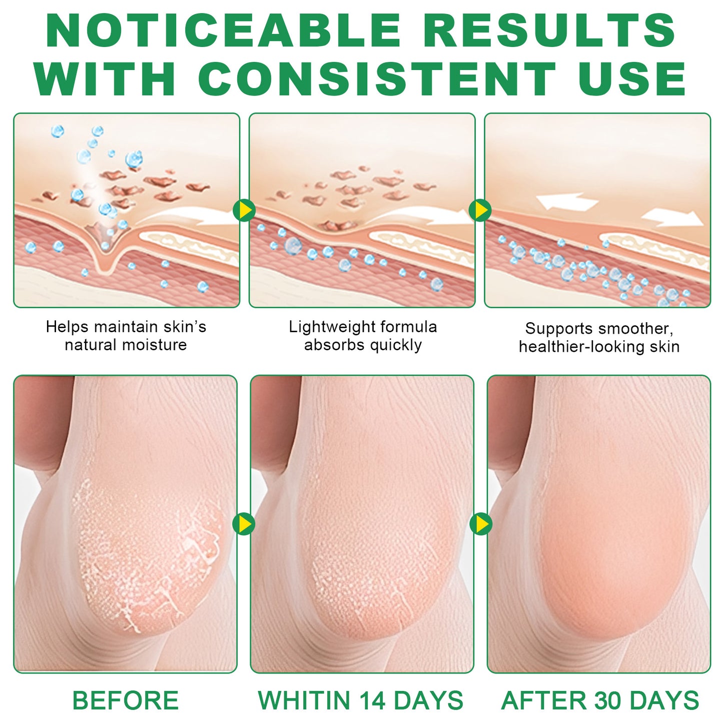 D.FAIRY CRACKED HEEL STICK 60% UREA + 2% SALICYLIC ACID