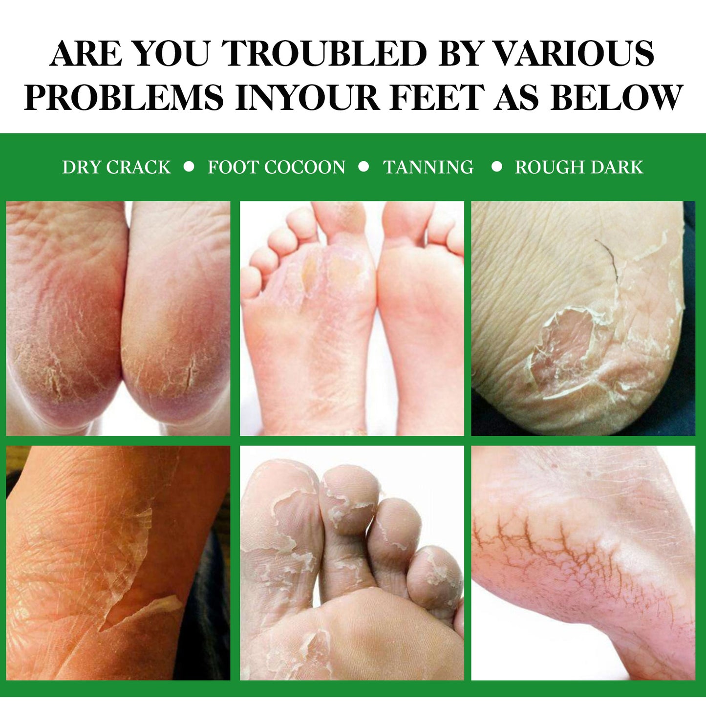 ZQZPZBPZ Aloe Exfoliating peeling foot mask